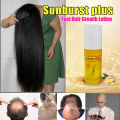 Nueva actualización 100% productos genuinos para el crecimiento del cabello Sunburst Plus Loción para el crecimiento del cabello 100 ml para una rápida pérdida de cabello